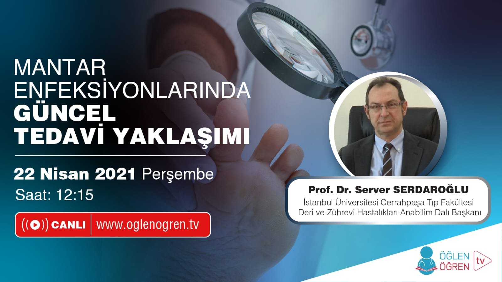 22.04.2021 tarihinde Mantar Enfeksiyonlarında Güncel Tedavi Yaklaşımı başlıklı programımız Öğlen Öğren TV ekranlarından canlı yayınlanacaktır