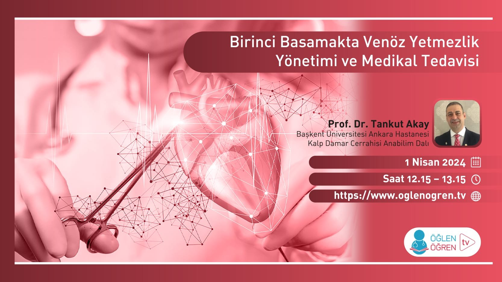 01.04.2024 tarihinde Birinci Basamakta Kronik Venöz Yetmezlik Yönetimi ve Medikal Tedavisi başlıklı programımız Öğlen Öğren TV ekranlarından canlı yayınlanacaktır