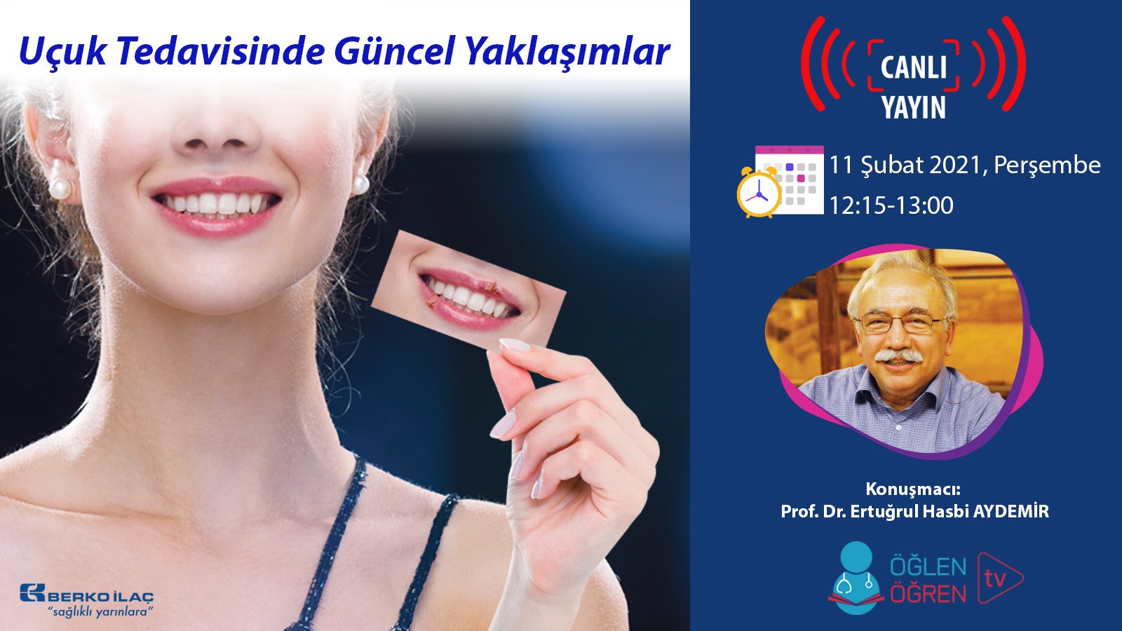 11.02.2021 tarihinde Uçuk Tedavisinde Güncel Yaklaşımlar başlıklı programımız Öğlen Öğren TV ekranlarından canlı yayınlanacaktır