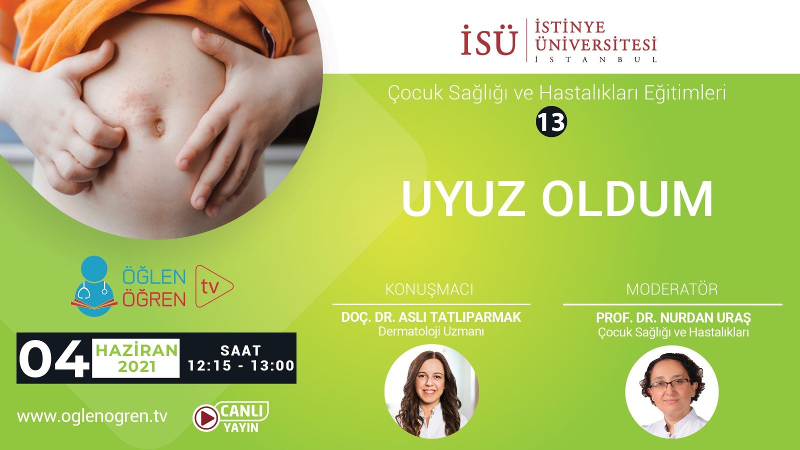 04.06.2021 tarihinde Uyuz Oldum başlıklı programımız Öğlen Öğren TV ekranlarından canlı yayınlanacaktır