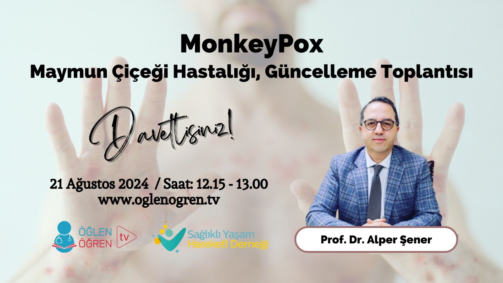 21.08.2024 tarihinde MonkeyPox Maymun Çiçeği Hastalığı Güncelleme Toplantısı başlıklı programımız Öğlen Öğren TV ekranlarından canlı yayınlanacaktır